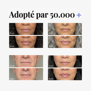 Repulpeur à lèvres — Classique